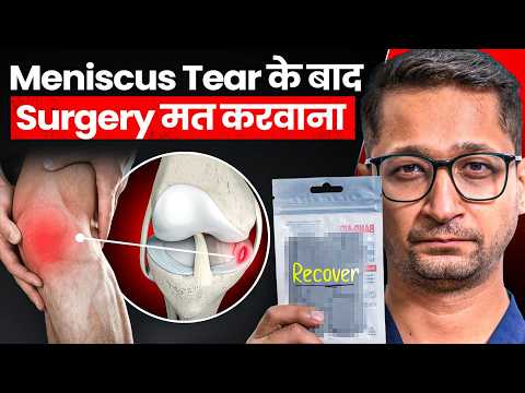 Fix Meniscus Tear without Surgery (100% Effective) | AIIMS Doctor Explains!
